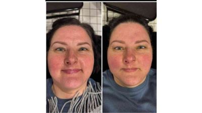 Masterclass Masaj Facial Sculptural Sibiu 