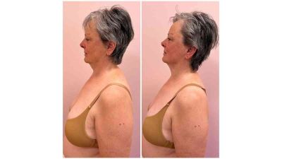 Masterclass Masaj Facial Sculptural Sibiu 