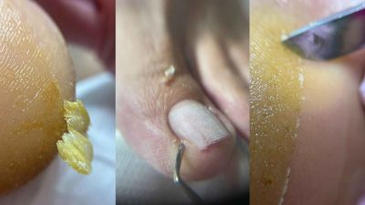 Curs Pedichiură Profesională Sibiu 