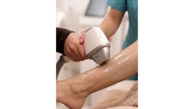 Curs Epilare definitivă cu laser și IPL București 