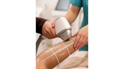 Curs Epilare definitivă cu laser și IPL București 