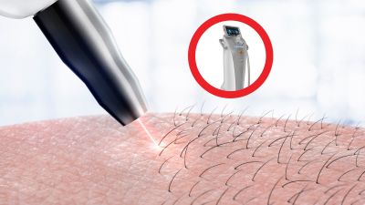 Masterclass Epilare laser Brașov 