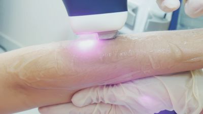 Masterclass Epilare laser Brașov 